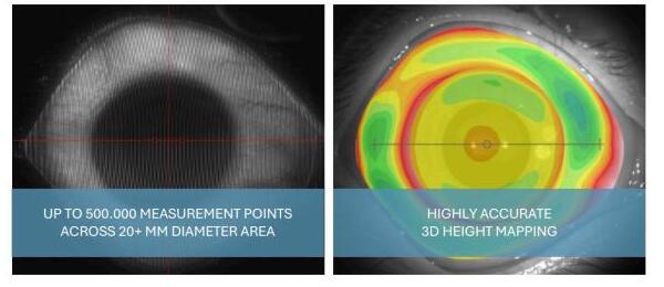 Profilometry scan and 3D height map of the eye surface